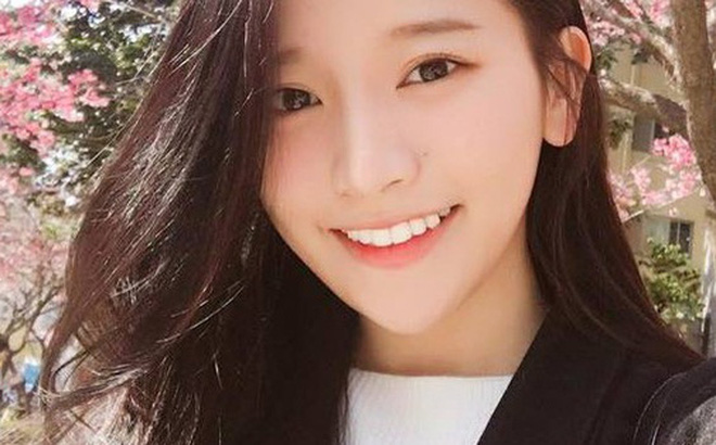 NHỮNG ĐIỀU BẠN CẦN BIẾT VỀ PHƯƠNG PHÁP CẦU RĂNG 1 photo1497322492414 1497322493059 0 27 314 533 crop 1497322522492