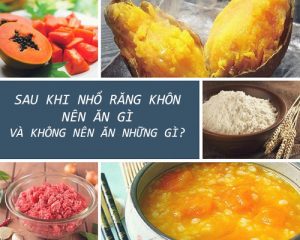 Sau khi nhổ răng khôn nên ăn gì và không nên ăn những gì?