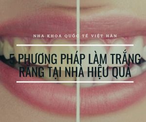 5 phương pháp làm trắng răng tại nhà hiệu quả